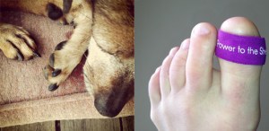 Yikes! Where's your toenail?